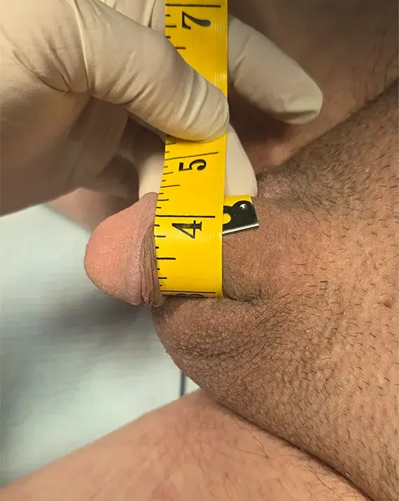 Before